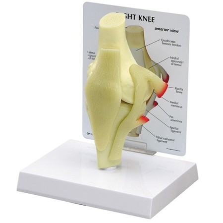GPI ANATOMICAL Anatomical Model - Knee 1000